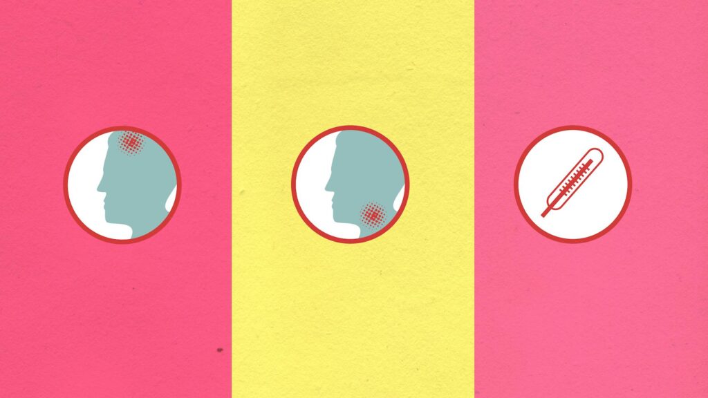 garforfans illustration